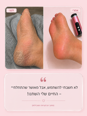 מארז פדיקור - ™TalveilCare